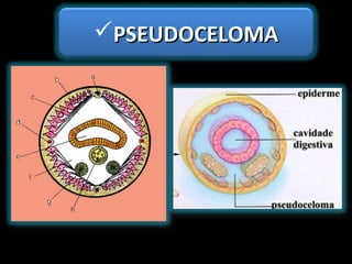 PSEUDOCELOMAPSEUDOCELOMA
 