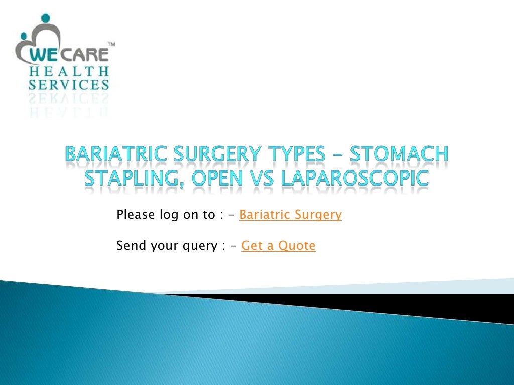 Bariatric Surgery Types Stomach Stapling, Open vs Laparoscopic
