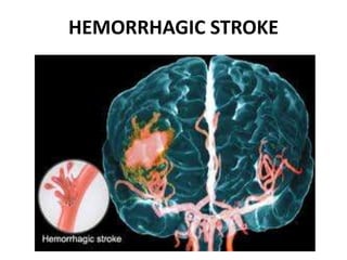HEMORRHAGIC STROKE
 