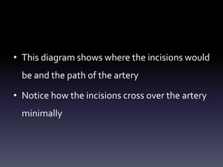 • This diagram shows where the incisions would
be and the path of the artery
• Notice how the incisions cross over the artery
minimally
 