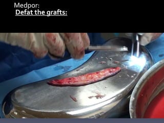 Medpor:
Defat the grafts:
 