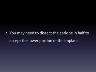 • You may need to dissect the earlobe in half to
accept the lower portion of the implant
 