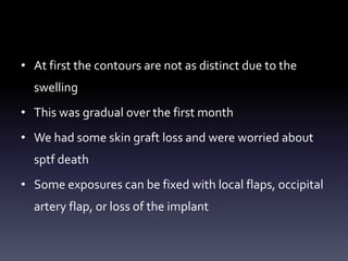 • At first the contours are not as distinct due to the
swelling
• This was gradual over the first month
• We had some skin graft loss and were worried about
sptf death
• Some exposures can be fixed with local flaps, occipital
artery flap, or loss of the implant
 