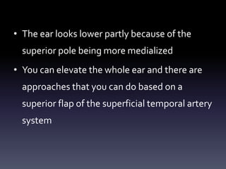 • The ear looks lower partly because of the
superior pole being more medialized
• You can elevate the whole ear and there are
approaches that you can do based on a
superior flap of the superficial temporal artery
system
 