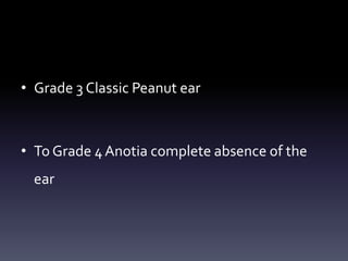 • Grade 3 Classic Peanut ear
• To Grade 4Anotia complete absence of the
ear
 