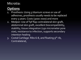 Microtia:
Options:
1. Prosthesis: Using 3 titanium screws or use of
adhesives, prosthesis usually needs to be replaced
every 3 years. Costs (3000-7000) and more
2. Medpor: Use ofTpf flap contralateral skin graft,
abdominal skin graft, excellent biocompatibility,
stability, tissue integration (150 micrometer pore
size), resistance to infection, supports secondary
intention healing
3. Costal Cartilage: Ribs 6-8, and floating 9th rib,
Contralateral,
 