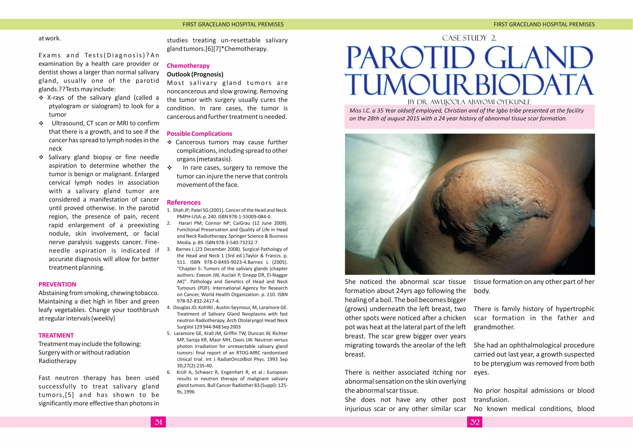 FIRST GRACELAND HOSPITAL PREMISES FIRST GRACELAND HOSPITAL PREMISES
atwork.
Exams and Tests(Diagnosis)? An
examination by a health care provider or
dentist shows a larger than normal salivary
gland, usually one of the parotid
glands.??Testsmayinclude:
vX-rays of the salivary gland (called a
ptyalogram or sialogram) to look for a
tumor
vUltrasound, CT scan or MRI to confirm
that there is a growth, and to see if the
cancerhasspreadtolymphnodesinthe
neck
vSalivary gland biopsy or fine needle
aspiration to determine whether the
tumor is benign or malignant. Enlarged
cervical lymph nodes in association
with a salivary gland tumor are
considered a manifestation of cancer
until proved otherwise. In the parotid
region, the presence of pain, recent
rapid enlargement of a preexisting
nodule, skin involvement, or facial
nerve paralysis suggests cancer. Fine-
needle aspiration is indicated if
accurate diagnosis will allow for better
treatmentplanning.
Abstainingfromsmoking,chewingtobacco.
Maintaining a diet high in fiber and green
leafy vegetables. Change your toothbrush
atregularintervals(weekly)
Treatmentmayincludethefollowing:
Surgerywithorwithoutradiation
Radiotherapy
Fast neutron therapy has been used
successfully to treat salivary gland
tumors,[5] and has shown to be
significantly more effective than photons in
PREVENTION
TREATMENT
studies treating un-resettable salivary
glandtumors.[6][7]*Chemotherapy.
Outlook(Prognosis)
Most salivary gland tumors are
noncancerous and slow growing. Removing
the tumor with surgery usually cures the
condition. In rare cases, the tumor is
cancerousandfurthertreatmentisneeded.
vCancerous tumors may cause further
complications,includingspreadtoother
organs(metastasis).
vIn rare cases, surgery to remove the
tumor can injure the nerve that controls
movementoftheface.
1. Shah JP; Patel SG (2001). Cancer of the Head and Neck.
PMPH-USA.p.240.ISBN978-1-55009-084-0.
2. Harari PM; Connor NP; CaiGrau (12 June 2009).
Functional Preservation and Quality of Life in Head
and Neck Radiotherapy. Springer Science & Business
Media.p.89.ISBN978-3-540-73232-7.
3. Barnes L (23 December 2008). Surgical Pathology of
the Head and Neck 1 (3rd ed.).Taylor & Francis. p.
511. ISBN 978-0-8493-9023-4.Barnes L (2005).
"Chapter 5: Tumors of the salivary glands (chapter
authors: Eveson JW, Auclair P, Gnepp DR, El-Naggar
AK)". Pathology and Genetics of Head and Neck
Tumours (PDF). International Agency for Research
on Cancer, World Health Organization. p. 210. ISBN
978-92-832-2417-4.
4. Douglas JD, KohWJ , Austin-Seymour, M, Laramore GE.
Treatment of Salivary Gland Neoplasms with fast
neutron Radiotherapy. Arch Otolaryngol Head Neck
SurgVol129944-948Sep2003
5. Laramore GE, Krall JM, Griffin TW, Duncan W, Richter
MP, Saroja KR, Maor MH, Davis LW. Neutron versus
photon irradiation for unresectable salivary gland
tumors: final report of an RTOG-MRC randomized
clinical trial. Int J RadiatOncolBiol Phys. 1993 Sep
30;27(2):235-40.
6. Krüll A, Schwarz R, Engenhart R, et al.: European
results in neutron therapy of malignant salivary
gland tumors. Bull Cancer Radiother 83 (Suppl): 125-
9s,1996
Chemotherapy
PossibleComplications
References
CASE STUDY 2.
By Dr. Awujoola Abayomi Oyekunle
PAROTID GLANDPAROTID GLAND
TUMOURBIODATATUMOURBIODATA
Miss I.C. a 35 Year oldself employed, Christian and of the Igbo tribe presented at the facility
on the 28th of august 2015 with a 24 year history of abnormal tissue scar formation.
She noticed the abnormal scar tissue
formation about 24yrs ago following the
healingofaboil.Theboilbecomesbigger
(grows) underneath the left breast, two
other spots were noticed after a chicken
pot was heat at the lateral part of the left
breast. The scar grew bigger over years
migrating towards the areolar of the left
breast.
There is neither associated itching nor
abnormal sensation on theskinoverlying
theabnormalscartissue.
She does not have any other post
injurious scar or any other similar scar
tissue formation on any other part of her
body.
There is family history of hypertrophic
scar formation in the father and
grandmother.
She had an ophthalmological procedure
carried out last year, a growth suspected
to be pterygium was removed from both
eyes.
No prior hospital admissions or blood
transfusion.
No known medical conditions, blood
3231
 