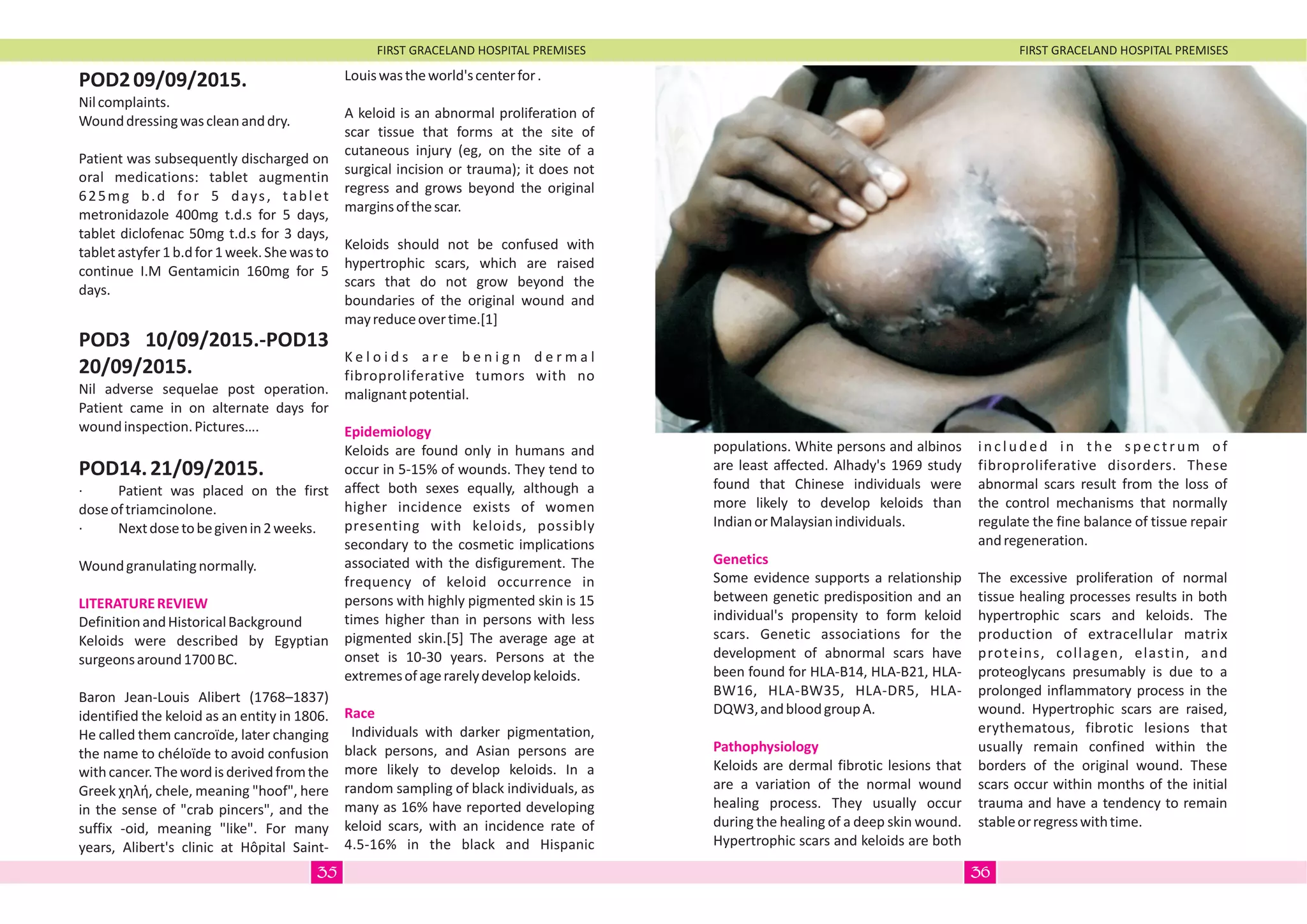 FIRST GRACELAND HOSPITAL PREMISES FIRST GRACELAND HOSPITAL PREMISES
POD209/09/2015.
Nilcomplaints.
Wounddressingwascleananddry.
Patient was subsequently discharged on
oral medications: tablet augmentin
625mg b.d for 5 days, tablet
metronidazole 400mg t.d.s for 5 days,
tablet diclofenac 50mg t.d.s for 3 days,
tabletastyfer1b.dfor1week.Shewasto
continue I.M Gentamicin 160mg for 5
days.
POD3 10/09/2015.-POD13
20/09/2015.
Nil adverse sequelae post operation.
Patient came in on alternate days for
woundinspection.Pictures….
POD14.21/09/2015.
· Patient was placed on the first
doseoftriamcinolone.
· Nextdosetobegivenin2weeks.
Woundgranulatingnormally.
DefinitionandHistoricalBackground
Keloids were described by Egyptian
surgeonsaround1700BC.
Baron Jean-Louis Alibert (1768–1837)
identified the keloid as an entity in 1806.
He called them cancroïde, later changing
the name to chéloïde to avoid confusion
withcancer.Thewordisderivedfromthe
Greek ÷çëﬁ, chele, meaning "hoof", here
in the sense of "crab pincers", and the
suffix -oid, meaning "like". For many
years, Alibert's clinic at Hôpital Saint-
LITERATUREREVIEW
Louiswastheworld'scenterfor.
A keloid is an abnormal proliferation of
scar tissue that forms at the site of
cutaneous injury (eg, on the site of a
surgical incision or trauma); it does not
regress and grows beyond the original
marginsofthescar.
Keloids should not be confused with
hypertrophic scars, which are raised
scars that do not grow beyond the
boundaries of the original wound and
mayreduceovertime.[1]
K e l o i d s a r e b e n i g n d e r m a l
fibroproliferative tumors with no
malignantpotential.
Keloids are found only in humans and
occur in 5-15% of wounds. They tend to
affect both sexes equally, although a
higher incidence exists of women
presenting with keloids, possibly
secondary to the cosmetic implications
associated with the disfigurement. The
frequency of keloid occurrence in
persons with highly pigmented skin is 15
times higher than in persons with less
pigmented skin.[5] The average age at
onset is 10-30 years. Persons at the
extremesofagerarelydevelopkeloids.
Individuals with darker pigmentation,
black persons, and Asian persons are
more likely to develop keloids. In a
random sampling of black individuals, as
many as 16% have reported developing
keloid scars, with an incidence rate of
4.5-16% in the black and Hispanic
Epidemiology
Race
populations. White persons and albinos
are least affected. Alhady's 1969 study
found that Chinese individuals were
more likely to develop keloids than
IndianorMalaysianindividuals.
Some evidence supports a relationship
between genetic predisposition and an
individual's propensity to form keloid
scars. Genetic associations for the
development of abnormal scars have
been found for HLA-B14, HLA-B21, HLA-
BW16, HLA-BW35, HLA-DR5, HLA-
DQW3,andbloodgroupA.
Keloids are dermal fibrotic lesions that
are a variation of the normal wound
healing process. They usually occur
during the healing of a deep skin wound.
Hypertrophic scars and keloids are both
Genetics
Pathophysiology
included in the spectrum of
fibroproliferative disorders. These
abnormal scars result from the loss of
the control mechanisms that normally
regulate the fine balance of tissue repair
andregeneration.
The excessive proliferation of normal
tissue healing processes results in both
hypertrophic scars and keloids. The
production of extracellular matrix
proteins, collagen, elastin, and
proteoglycans presumably is due to a
prolonged inflammatory process in the
wound. Hypertrophic scars are raised,
erythematous, fibrotic lesions that
usually remain confined within the
borders of the original wound. These
scars occur within months of the initial
trauma and have a tendency to remain
stableorregresswithtime.
3635
 