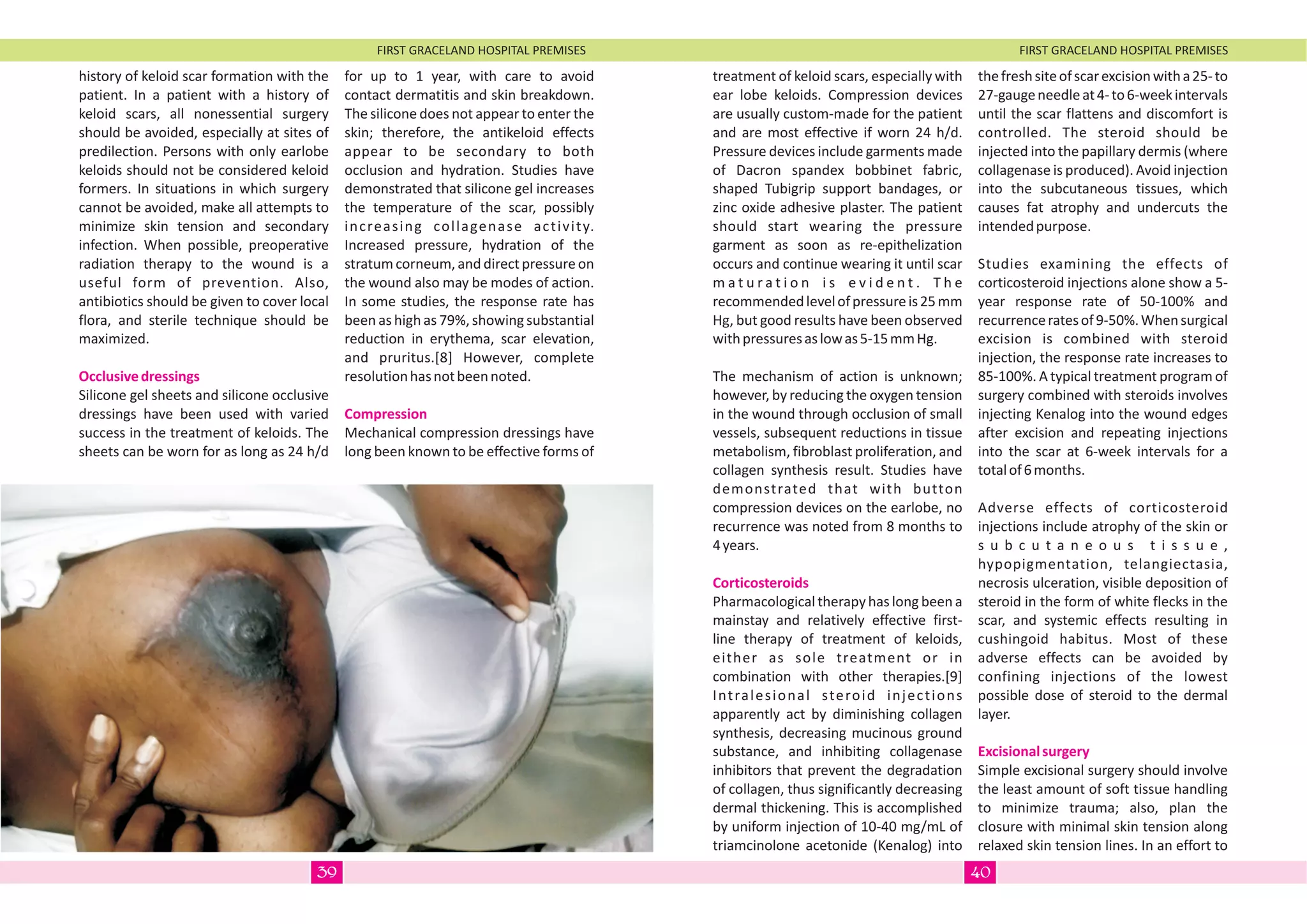 FIRST GRACELAND HOSPITAL PREMISES FIRST GRACELAND HOSPITAL PREMISES
history of keloid scar formation with the
patient. In a patient with a history of
keloid scars, all nonessential surgery
should be avoided, especially at sites of
predilection. Persons with only earlobe
keloids should not be considered keloid
formers. In situations in which surgery
cannot be avoided, make all attempts to
minimize skin tension and secondary
infection. When possible, preoperative
radiation therapy to the wound is a
useful form of prevention. Also,
antibiotics should be given to cover local
flora, and sterile technique should be
maximized.
Silicone gel sheets and silicone occlusive
dressings have been used with varied
success in the treatment of keloids. The
sheets can be worn for as long as 24 h/d
Occlusivedressings
for up to 1 year, with care to avoid
contact dermatitis and skin breakdown.
The silicone does not appear to enter the
skin; therefore, the antikeloid effects
appear to be secondary to both
occlusion and hydration. Studies have
demonstrated that silicone gel increases
the temperature of the scar, possibly
increasing collagenase activity.
Increased pressure, hydration of the
stratum corneum, and direct pressure on
the wound also may be modes of action.
In some studies, the response rate has
been as high as 79%, showing substantial
reduction in erythema, scar elevation,
and pruritus.[8] However, complete
resolutionhasnotbeennoted.
Mechanical compression dressings have
long been known to be effective forms of
Compression
treatment of keloid scars, especially with
ear lobe keloids. Compression devices
are usually custom-made for the patient
and are most effective if worn 24 h/d.
Pressure devices include garments made
of Dacron spandex bobbinet fabric,
shaped Tubigrip support bandages, or
zinc oxide adhesive plaster. The patient
should start wearing the pressure
garment as soon as re-epithelization
occurs and continue wearing it until scar
m a t u r a t i o n i s e v i d e n t . T h e
recommendedlevelofpressureis25mm
Hg, but good results have been observed
withpressuresaslowas5-15mmHg.
The mechanism of action is unknown;
however, by reducing the oxygen tension
in the wound through occlusion of small
vessels, subsequent reductions in tissue
metabolism, fibroblast proliferation, and
collagen synthesis result. Studies have
demonstrated that with button
compression devices on the earlobe, no
recurrence was noted from 8 months to
4years.
Pharmacological therapyhas long been a
mainstay and relatively effective first-
line therapy of treatment of keloids,
either as sole treatment or in
combination with other therapies.[9]
Intralesional steroid injections
apparently act by diminishing collagen
synthesis, decreasing mucinous ground
substance, and inhibiting collagenase
inhibitors that prevent the degradation
of collagen, thus significantly decreasing
dermal thickening. This is accomplished
by uniform injection of 10-40 mg/mL of
triamcinolone acetonide (Kenalog) into
Corticosteroids
thefreshsiteofscarexcisionwitha25-to
27-gaugeneedleat4-to6-weekintervals
until the scar flattens and discomfort is
controlled. The steroid should be
injected into the papillary dermis (where
collagenase is produced). Avoid injection
into the subcutaneous tissues, which
causes fat atrophy and undercuts the
intendedpurpose.
Studies examining the effects of
corticosteroid injections alone show a 5-
year response rate of 50-100% and
recurrenceratesof9-50%.Whensurgical
excision is combined with steroid
injection, the response rate increases to
85-100%. A typical treatment program of
surgery combined with steroids involves
injecting Kenalog into the wound edges
after excision and repeating injections
into the scar at 6-week intervals for a
totalof6months.
Adverse effects of corticosteroid
injections include atrophy of the skin or
s u b c u t a n e o u s t i s s u e ,
hypopigmentation, telangiectasia,
necrosis ulceration, visible deposition of
steroid in the form of white flecks in the
scar, and systemic effects resulting in
cushingoid habitus. Most of these
adverse effects can be avoided by
confining injections of the lowest
possible dose of steroid to the dermal
layer.
Simple excisional surgery should involve
the least amount of soft tissue handling
to minimize trauma; also, plan the
closure with minimal skin tension along
relaxed skin tension lines. In an effort to
Excisionalsurgery
4039
 
