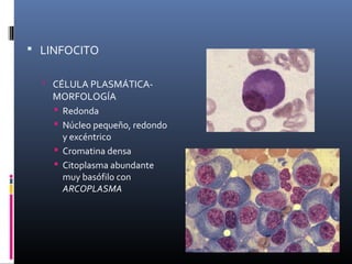  LINFOCITO

   CÉLULA PLASMÁTICA-
   MORFOLOGÍA
    Redonda
    Núcleo pequeño, redondo
     y excéntrico
    Cromatina densa
    Citoplasma abundante
     muy basófilo con
     ARCOPLASMA
 