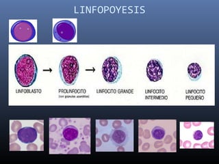LINFOPOYESIS
 