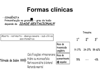 Formas clínicas
 
