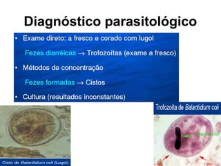Diagnóstico parasitológico
 