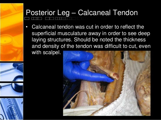 cadaver presentation