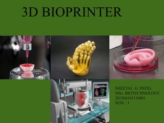 SHEETAL G. PATEL
MSc. BIOTECHNOLOGY
201504101110001
SEM : I
3D BIOPRINTER
 