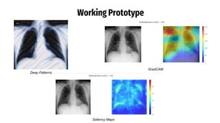 Working Prototype
Deep Patterns
GradCAM
Saliency Maps
 
