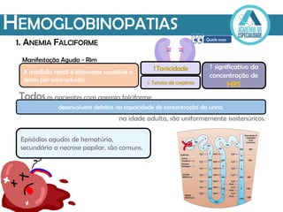 Manifestação Aguda - Rim
HEMOGLOBINOPATIAS
1. ANEMIA FALCIFORME
A medula renal é altamente suscetível a
danos por vaso-oclusão.
desenvolvem defeitos na capacidade de concentração da urina.
Tonicidade
 Tensão de oxigénio
 significativo da
concentração de
HBS
Todos os pacientes com anemia falciforme
na idade adulta, são uniformemente isostenúricos.
Episódios agudos de hematúria,
secundária a necrose papilar, são comuns.
 
