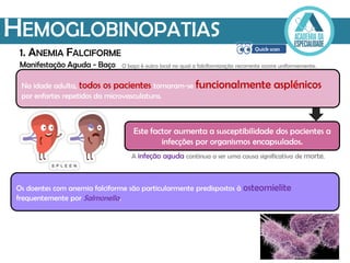 Manifestação Aguda - Baço
HEMOGLOBINOPATIAS
1. ANEMIA FALCIFORME
Na idade adulta, todos os pacientes tornaram-se funcionalmente asplénicos
por enfartes repetidos da microvasculatura.
Este factor aumenta a susceptibilidade dos pacientes a
infecções por organismos encapsulados.
Os doentes com anemia falciforme são particularmente predispostos à osteomielite
frequentemente por Salmonella.
O baço é outro local no qual a falciformização recorrente ocorre uniformemente.
A infeção aguda continua a ser uma causa significativa de morte.
 