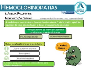 Manifestação Crónica
HEMOGLOBINOPATIAS
1. ANEMIA FALCIFORME
À medida que mais pacientes foram sobrevivendo até à idade adulta, episódios
repetidos de vaso-oclusão levam a danos em quase todos os orgãos
Princípais causas de morte em pacientes
adultos com anemia falciforme.
A maioria dos pacientes requer colecistectomia para
cálculos pigmentares.
A anemia falciforme era uma doença infantil
Insuficiência Renal Insuficiência Pulmonar
Outras complicações a longo prazo incluem:
1 Úlceras cutâneas crónicas
2 Retinopatia
3 Disfunção hepática
 