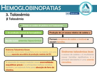HEMOGLOBINOPATIAS
β Talassémia
 Síntese na cadeia de globina na β-talassemia
 da produção normal de hemoglobina Produção de um excesso relativo de cadeias α
Resulta numa anemia hipocrómica
Formam complexos de cadeia α insolúveis e
causam hemólise.
Síndromes talassêmicas leves
o excesso de cadeias α é insuficiente
causar hemólise significativa, e a
principal descoberta é uma anemia
microcítica.
Síndromes Talassémicos Graves
A hemólise ocorre tanto na periferia como na medula, com uma
intensa expansão secundária da produção medular de GV.
A expansão do espaço medular causa anormalidades
esqueléticas graves e a eritropoiese ineficaz constitui,
também, um estímulo forte para absorção de ferro do
intestino.
3. Talassémia
 