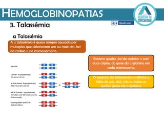 HEMOGLOBINOPATIAS
α Talassémia
A α talassémia é quase sempre causada por
mutações que delecionam um ou mais dos loci
da cadeia α no cromossoma 16.
Existem quatro loci de cadeias α com
duas cópias, do gene da α-globina em
cada cromossoma.
O espectro da talassemia-α reflecte a
falta de um, dois, três ou todos os
quatro genes da α-globina.
3. Talassémia
 