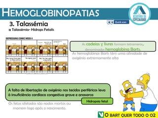 HEMOGLOBINOPATIAS
α Talassémia- Hidrops Fetalis
As cadeias ɣ livres formam tetrameros,
denominados hemoglobina Barts.
A falta de libertação de oxigénio nos tecidos periféricos leva
à insuficiência cardíaca congestiva grave e anasarca
Hidropsia fetal
3. Talassémia
As hemoglobinas Barts têm uma afinidade de
oxigénio extremamente alta
Os fetos afetados são nados mortos ou
morrem logo após o nascimento.
O BART QUER TODO O O2
 