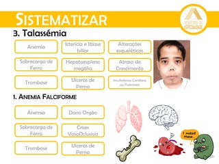 SISTEMATIZAR
Anemia
Icterícia e litíase
biliar
Alterações
esqueléticas
Sobrecarga de
Ferro
Atraso de
Crescimento
Hepatoespleno
megália
Trombose Ulceras de
Perna
Insuficiência Cardíaca
ou Pulmonar
3. Talassémia
1. ANEMIA FALCIFORME
Anemia
Sobrecarga de
Ferro
Trombose Ulceras de
Perna
Dano Orgão
Crises
VasoOclusiva
 