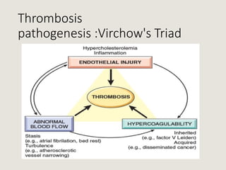 Share_presentation_on_DVT_by_Dr._Monira.pptx