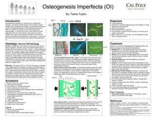 Osteogenesis Imperfecta (OI)
By: Tasha Taylor
Introduction
Osteogenesis Imperfecta (OI), also known as “Brittle Bone
Disease”, is a genetic disorder based on the mutation of type 1
collagen fiber, increased bone fragility, and decreased bone mass.
There is no significant difference in the likelihood of having OI
when it comes to men,women,or race. Each year there is
approximately 1 in 20,000 born with OI, with 25,000 to 50,000
diagnosed in the US.There are four major types of OI (type I-
mildest, type II-fatal, type III-severe, and type IV-mild) and two
which are classified as “Silenced”(type V and type VI). Type IV will
be the primary focus when going into histologic detail (see figure
1).
Diagnosis
● Clinical Diagnosis
● Physician or geneticist diagnoses types of OI based on clinical
features and bone fractures
● Blood and urine tests
● Prenatal diagnosis by ultrasound
● First indication is broken bones from little or no trauma as an
infant or young child.
● Milder cases of OI, such as type I, are not diagnosed til early
teen or young adult years.
Histology: Normal VS Pathology
Normal: Collagen fiber, which allows movement, can be found in
bones, ligaments, and skin. Type I is the most abundant type of
collagen fiber found within the body. In figure 1, normal histology of
bone marrow in the iliac shows normal trabeculae that is abundant
and thick. The lamellae collagen fiber is parallel to one another,
smooth, and thick. (Figure 2) Osteoblasts that are found within the
endosteum, lining the bone marrow, help lay down new bone
matrix. Osteoclasts however break down bone matrix to allow
osteoblasts to recreate new bone. The periosteum, not pictured, is
a fibrous connective tissue that contain cells called fibroblasts that
make the collagen fibers.
Pathology: The genes COL1A1 and COL1A2 undergo a mutation.
This causes slow bone formation, a change in the organization of
collagen fiber making up the trabecular lamellae (figure 1: second
row). Trabeculae are abnormally small and thin (blue). In Figure 2,
the number of osteoblasts is raised, so the rate of bone formation
is increased. However, because Osteoclast increased as well,
trabecular bone mass does not increase. Cortical and trabecular
compartments shrink causing thin bones compared to normal.
Symptoms
● Broken, deformed, or pain in bones
● Decreased bone density
● Short stature or crooked/curved spine
● Muscle weakness and loose joints
● Abnormal skull features such as greater head circumference
● Respiratory problems
● Hearing loss by young adulthood to middle age
● Dentinogenesis imperfecta or brittle teeth occur in 50% of
people diagnosed with OI
● Bruise easily
● Cardiac and fatigue issues
● Vision impairment
● Fragile skin and blood vessels
● Blueish color of the schlera
Type IV
● Shorter than normal stature
● Mild bone deformity
● Mild frequent fractures mostly before puberty
Treatment
There is no cure for Osteogenesis Imperfecta (OI), but
there are ways to help treat the symptoms.
● Medications, such as bisphosphonate drugs, and dietary
supplements such as Calcium Acetate help increase bone
density: growth hormone and gene therapies
● Devices such as a short term/lightweight splint or orthopedic
cast are used to stabilize, protect, and limit motion to injured
bones and joints
● Physical therapy helps with strengthening muscle and
increasing motor skill
● Surgery is used to repair broken bones, bowing legs, curved
spines, and impaired hearing. Rodding is used where metal rods
are placed within long bones to reduce bones from breaking or
deforming. Some surgeries pull the bones apart to lengthen
them so new bone can grow
● Maintaining a healthy lifestyle by taking in a nutritious diet
with vitamin D is essential. Weight control is important because
weight can add pressure to the heart and bones. Staying away
from products that can reduce bone density, such as alcohol
and caffeine, will help reduce risk.
● For severe cases where breathing is difficult, supplemental
oxygen is needed
● For severe cases with limited mobility: crutches, wheelchairs,
walkers, or canes
● If teeth are brittle crowns can be worn
● For the small percentage with hearing loss due to tiny bone
fractures in the ears, hearing aids are used
Future Treatments
● Gene based therapy: elimination of mutant gene or gene
product, or inactivate mutant allele
References
Glorieux, F. H., Ward, L. M., Rauch, F., Lalic, L., Roughley, P. J., & Travers, R. (2002).
Osteogenesis Imperfecta Type VI: A Form of Brittle Bone Disease with a Mineralization
Defect. J Bone Miner Res Journal of Bone and Mineral Research, 17(1), 30-38. doi:10.1359
/jbmr.2002.17.1.30
Rauch, F., & Glorieux, F. H. (2004). Osteogenesis imperfecta. The Lancet, 363(9418),
1377-1385. doi:10.1016/s0140-6736(04)16051-0
Rauch, F., & Glorieux, F. H. (2005). Osteogenesis imperfecta, current and future medical
treatment. Am. J. Med. Genet. American Journal of Medical Genetics Part C: Seminars in
Medical Genetics, 139C(1), 31-37. doi:10.1002/ajmg.c.30072
Subscribe to theBreakthrough Newsletter orE-News. (n.d.). Retrieved June 02, 2016, from
http://www.oif.org/site/PageServer?pagename=AOI_Facts
Normal Bone (Left): Cortical width and trabecular compartment of the bone is
much wider due to greater bone thickness. Trabeculae are abundant. The
number of osteoclast, cells that destroy bone tissue, and osteoblasts, cells that
build bone tissue, are within normal ratio.
Osteogenesis Imperfecta (Right): Trabeculae are few in numbers and
smaller in size. Over abundance of osteoblasts and osteoclasts. Bone is thin
and cortical width and trabecular compartment are narrow.
Top Control/Normal (from left to right): 1.) Histology of iliac crest bone from
a normal control 12 year old. Cancellous bone contains trabeculae (blue) that
penetrates the bone marrow(red): is abundant and thick. Width and thickness
of bone is normal in size. 2.) Collagen fibers (lines in blue) run parallel to each
other and is smooth. 3.) Fluorescent takes in tetracycline labels( shows
mineralization) normally.
Bottom Type IV (from left to right): 1.) Significantly smaller biopsy size: width
decreased. Decreased amount of cancellous (Less trabeculae/abnormal) and
cortical bone. 2.)Lamellae, in which contains collagen fibers, was irregular,
thinner, but organization is normal 3.) Fluorescent light shows normal uptake of
tetracycline where as other types have poor uptake.
Figure 1
1
2
3
Figure 2
trabeculae Lamellae
Bone
Marrow
Lamellae
Collagen
fibers
 