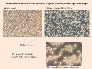 Whole blood 10 times diluted blood blood
10 times diluted blood , Magnified
RBCs
Red arrows( )indicate
Shrunk RBCs (on Crenation)
Observation of Blood fractions at various stages of filtration, under a light microscope
 