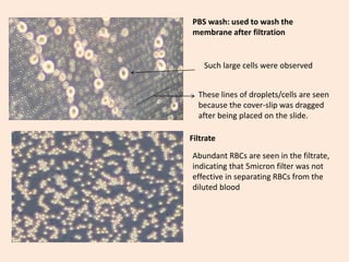 Filtrate
PBS wash: used to wash the
membrane after filtration
Such large cells were observed
These lines of droplets/cells are seen
because the cover-slip was dragged
after being placed on the slide.
Abundant RBCs are seen in the filtrate,
indicating that 5micron filter was not
effective in separating RBCs from the
diluted blood
 