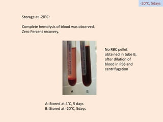 -20°C, 5days
Storage at -20°C:
Complete hemolysis of blood was observed.
Zero Percent recovery.
A B
A: Stored at 4°C, 5 days
B: Stored at -20°C, 5days
No RBC pellet
obtained in tube B,
after dilution of
blood in PBS and
centrifugation
 