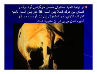 ‫و‬ ‫ﺑﻮدﻩ‬ ‫ﮔﺮد‬ ‫ﺧﺮﮔﻮﺷﻲ‬ ‫ﻣﻔﺼﻞ‬ ‫اﺳﺘﺨﻮان‬ ‫ﻥﺎﺣﻴﻪ‬ ‫اﻳﻨﺠﺎ‬ ‫در‬‫و‬ ‫ﺑﻮدﻩ‬ ‫ﮔﺮد‬ ‫ﺧﺮﮔﻮﺷﻲ‬ ‫ﻣﻔﺼﻞ‬ ‫اﺳﺘﺨﻮان‬ ‫ﻥﺎﺣﻴﻪ‬ ‫اﻳﻨﺠﺎ‬ ‫در‬
‫اﺳﺖ‬ ‫ﭘﻬﻦ‬ ‫آﺎﻣﻼ‬ ‫هﻮك‬ ‫ﺑﻴﻦ‬ ‫ﻓﻀﺎي‬‫اﺳﺖ‬ ‫ﭘﻬﻦ‬ ‫آﺎﻣﻼ‬ ‫هﻮك‬ ‫ﺑﻴﻦ‬ ‫ﻓﻀﺎي‬..‫اﺳﺖ‬ ‫ﭘﻬﻦ‬ ‫ﻥﻴﺰ‬ ‫آﻔﻞ‬‫اﺳﺖ‬ ‫ﭘﻬﻦ‬ ‫ﻥﻴﺰ‬ ‫آﻔﻞ‬..‫ﻥﺎﺣﻴﻪ‬‫ﻥﺎﺣﻴﻪ‬
‫ﺁﺙﺎر‬ ‫و‬ ‫ﺑﻮدﻩ‬ ‫ﮔﺮد‬ ‫ﻥﻴﺰ‬ ‫ﭘﻴﻦ‬ ‫اﺳﺘﺨﻮان‬ ‫و‬ ‫دم‬ ‫اﻥﺘﻬﺎي‬ ‫اﻃﺮاف‬‫ﺁﺙﺎر‬ ‫و‬ ‫ﺑﻮدﻩ‬ ‫ﮔﺮد‬ ‫ﻥﻴﺰ‬ ‫ﭘﻴﻦ‬ ‫اﺳﺘﺨﻮان‬ ‫و‬ ‫دم‬ ‫اﻥﺘﻬﺎي‬ ‫اﻃﺮاف‬
‫اﺳﺖ‬ ‫ﻣﺸﻬﻮد‬ ‫ﺁن‬ ‫در‬ ‫ﭼﺮﺑﻲ‬ ‫ﺷﺪن‬ ‫ذﺧﻴﺮﻩ‬‫اﺳﺖ‬ ‫ﻣﺸﻬﻮد‬ ‫ﺁن‬ ‫در‬ ‫ﭼﺮﺑﻲ‬ ‫ﺷﺪن‬ ‫ذﺧﻴﺮﻩ‬..
 