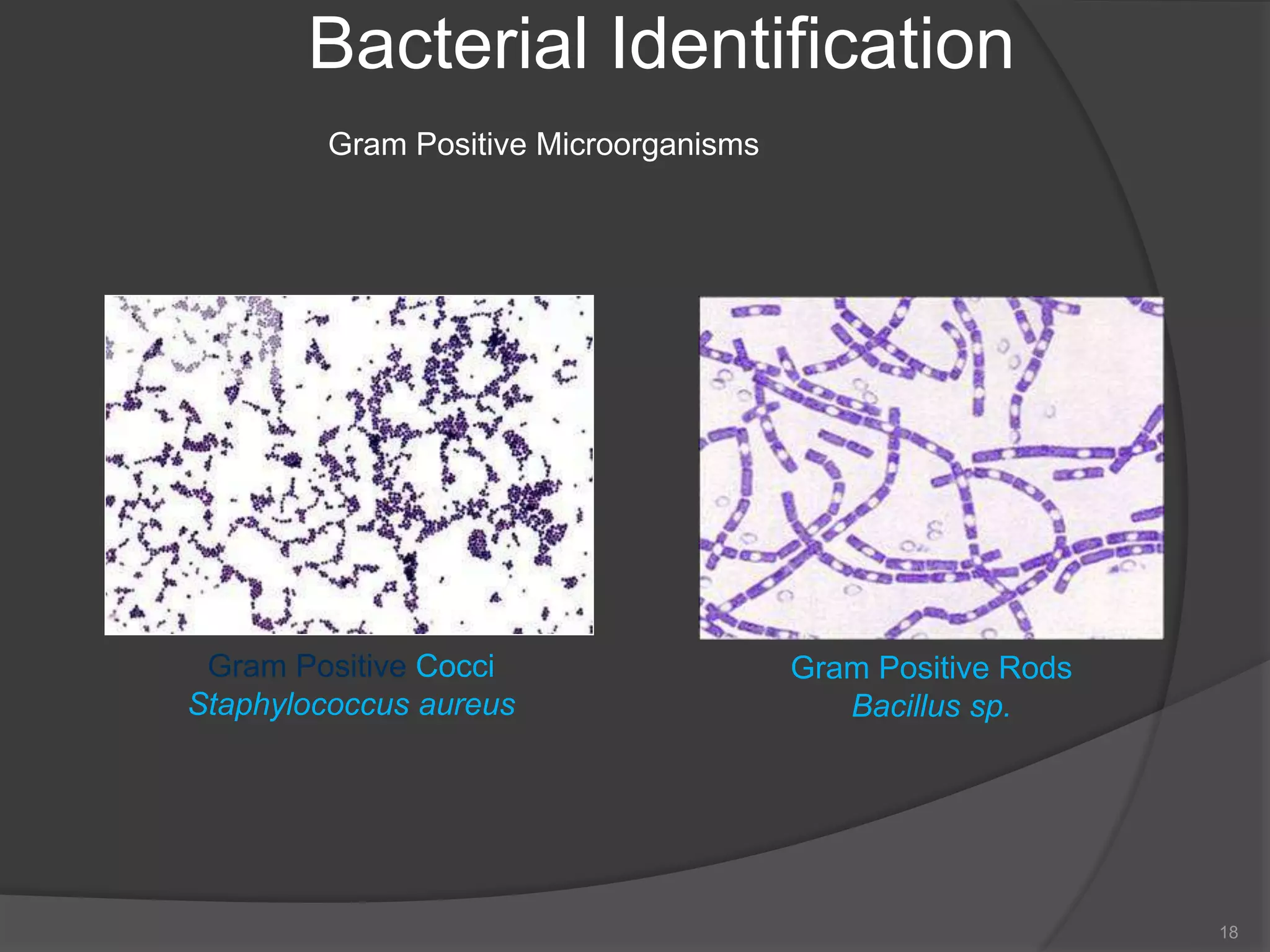 Bacterial Identification
Gram Positive Microorganisms
18
Gram Positive Cocci
Staphylococcus aureus
Gram Positive Rods
Bacillus sp.
 