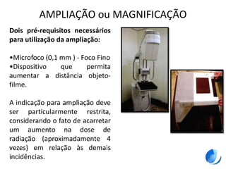 AMPLIAÇÃO ou MAGNIFICAÇÃO
Dois pré-requisitos necessários
para utilização da ampliação:
•Microfoco (0,1 mm ) - Foco Fino
•Dispositivo que permita
aumentar a distância objeto-
filme.
A indicação para ampliação deve
ser particularmente restrita,
considerando o fato de acarretar
um aumento na dose de
radiação (aproximadamente 4
vezes) em relação às demais
incidências.
 