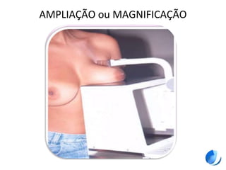 AMPLIAÇÃO ou MAGNIFICAÇÃO
 