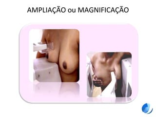 AMPLIAÇÃO ou MAGNIFICAÇÃO
 