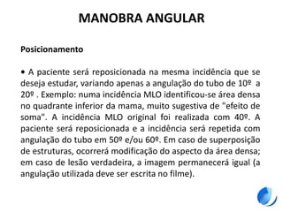 MANOBRA ANGULAR
Posicionamento
• A paciente será reposicionada na mesma incidência que se
deseja estudar, variando apenas a angulação do tubo de 10º a
20º . Exemplo: numa incidência MLO identificou-se área densa
no quadrante inferior da mama, muito sugestiva de "efeito de
soma". A incidência MLO original foi realizada com 40º. A
paciente será reposicionada e a incidência será repetida com
angulação do tubo em 50º e/ou 60º. Em caso de superposição
de estruturas, ocorrerá modificação do aspecto da área densa;
em caso de lesão verdadeira, a imagem permanecerá igual (a
angulação utilizada deve ser escrita no filme).
 