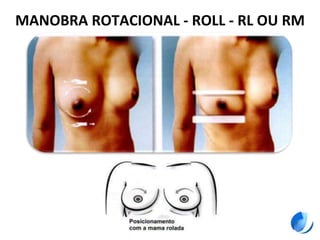 MANOBRA ROTACIONAL - ROLL - RL OU RM
 
