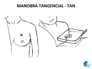 MANOBRA TANGENCIAL - TAN
 
