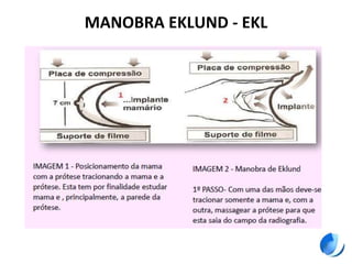 MANOBRA EKLUND - EKL
 