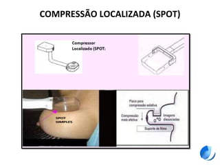 COMPRESSÃO LOCALIZADA (SPOT)
 