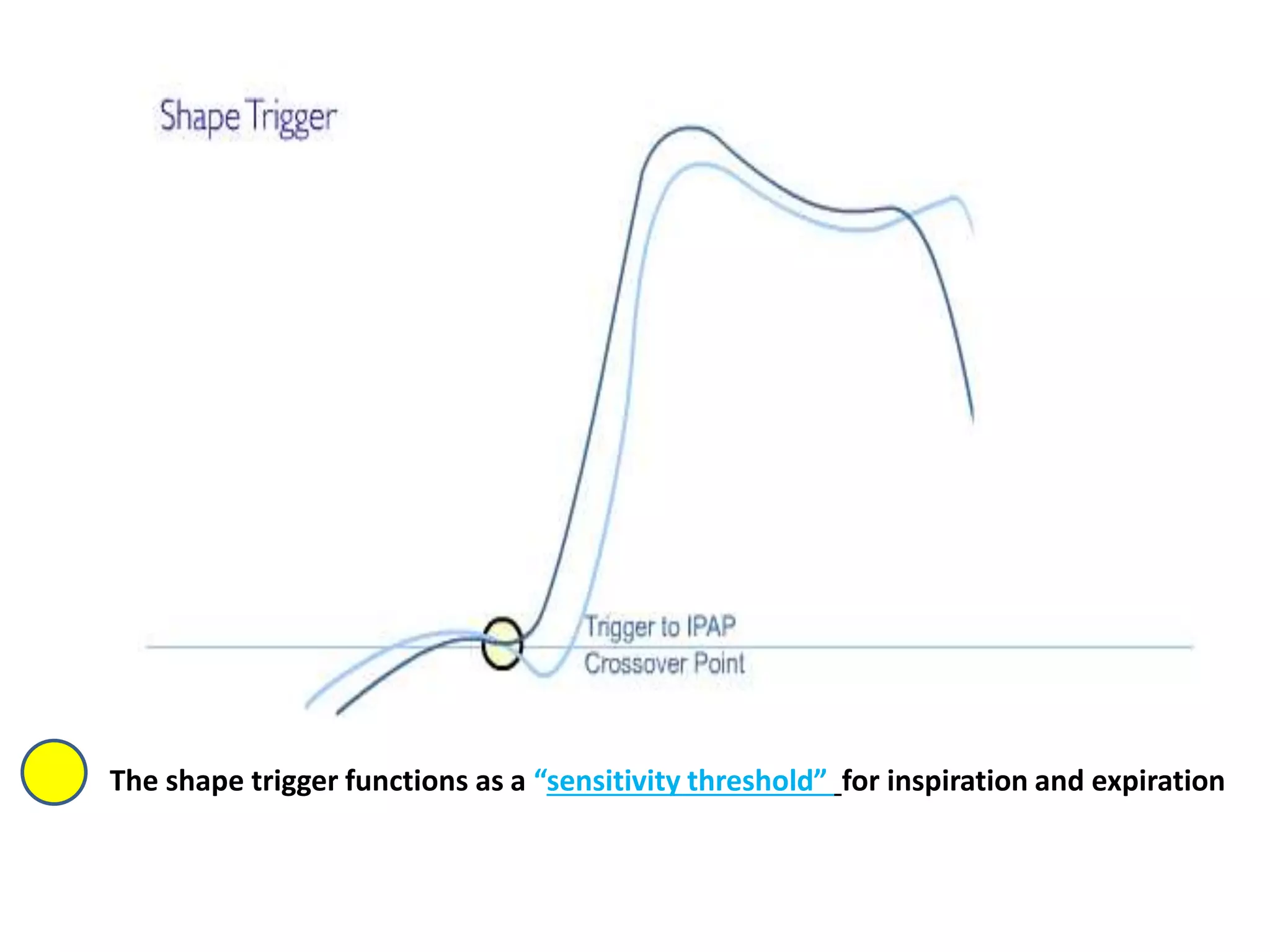 The shape trigger functions as a “sensitivity threshold” for inspiration and expiration
 