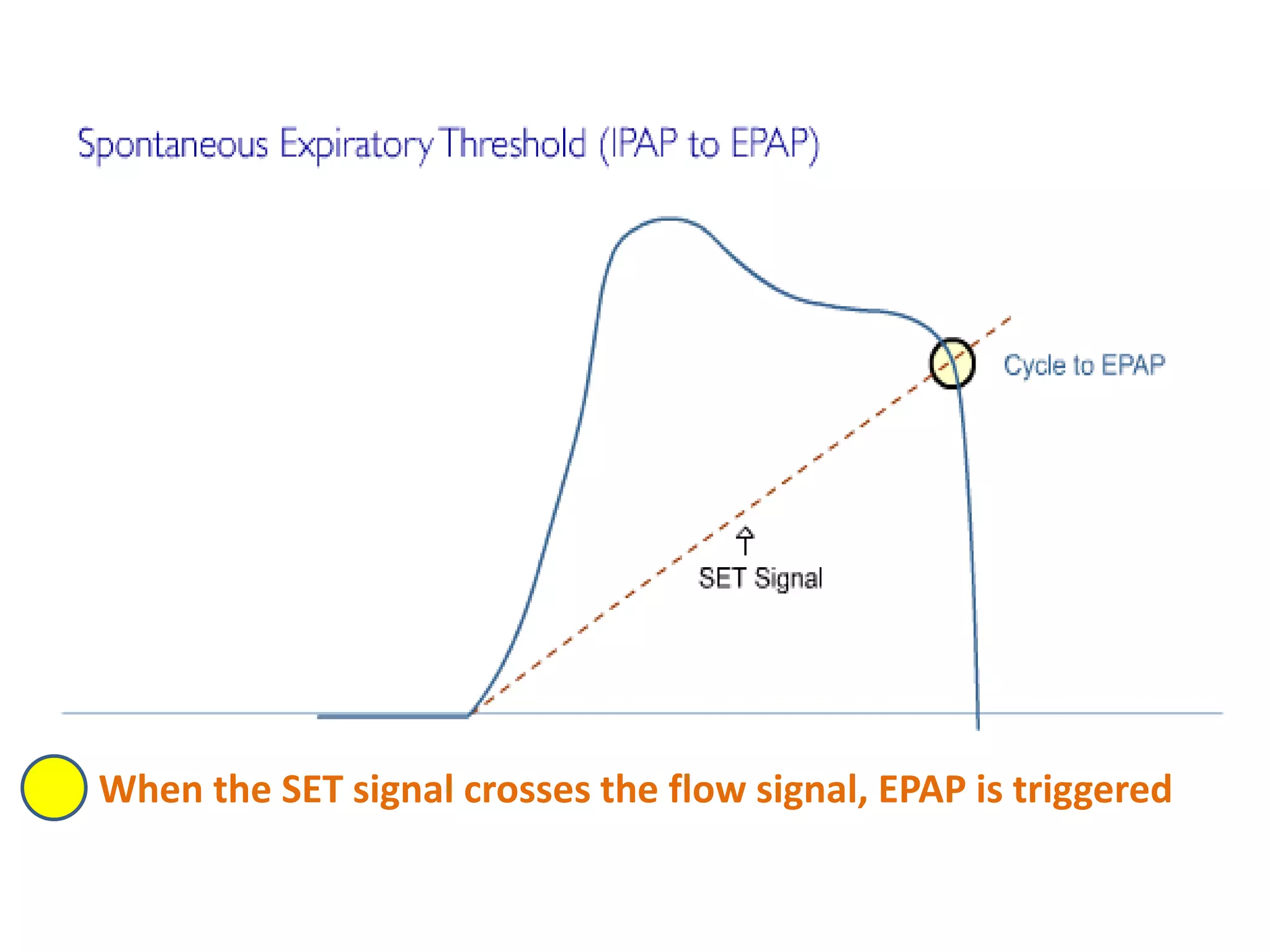 When the SET signal crosses the flow signal, EPAP is triggered
 