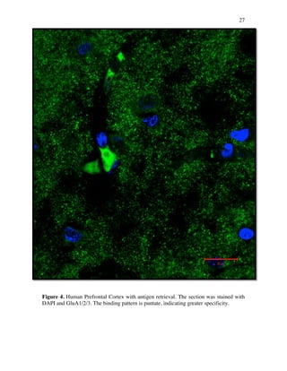 27
Figure 4. Human Prefrontal Cortex with antigen retrieval. The section was stained with
DAPI and GluA1/2/3. The binding pattern is puntate, indicating greater specificity.
 