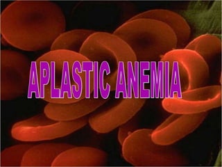 APLASTIC ANEMIA 