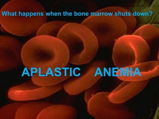 APLASTIC  ANEMIA What happens when the bone marrow shuts down? 
