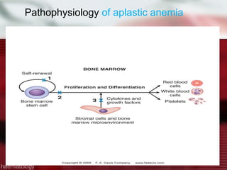 Pathophysiology  of aplastic anemia 