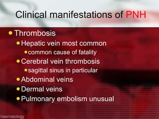 Clinical manifestations of  PNH Thrombosis Hepatic vein most common common cause of fatality Cerebral vein thrombosis sagittal sinus in particular Abdominal veins Dermal veins Pulmonary embolism unusual 