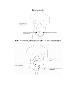 Dolor constante




Dolor intermitente, cólico en aumento, con intervalos sin dolor
 